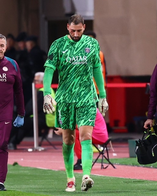 爱游戏登录入口-巴拿马女足球员在比赛中受伤